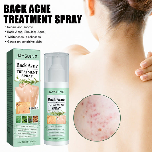 Clear Skin Back Spray
