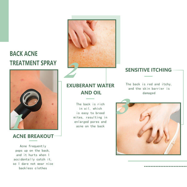 Clear Skin Back Spray